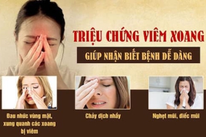 VIÊM XOANG VÀ NHỮNG ĐIỀU CẦN BIẾT ?