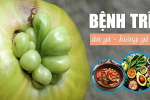  DINH DƯỠNG CHO NGƯỜI BỆNH TRĨ 