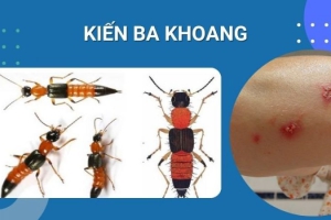 LÀM THẾ NÀO KHI BỊ KIẾN BA KHOANG CẮN 