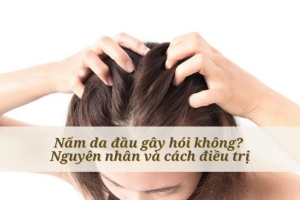  NẤM DA ĐẦU LÀ GÌ?