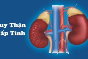  Suy thận cấp là gì?