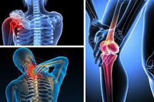 NGĂN NGỪA BỆNH VIÊM XƯƠNG KHỚP