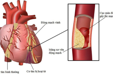 TIM ĐẬP NHANH???