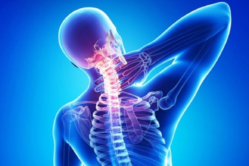 THOÁI HÓA ĐỐT SỐNG CỔ