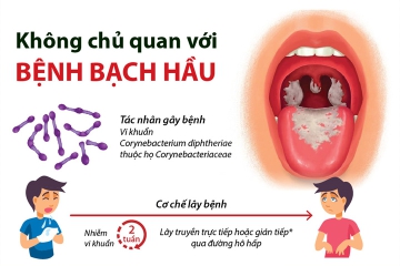 NHỮNG ĐIỀU CẦN BIẾT VỀ BỆNH BẠCH HẦU