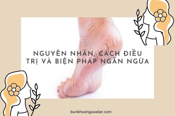 NỨT GÓT CHÂN LÀ GÌ? NHỮNG ĐIỀU BẠN CẦN BIẾT
